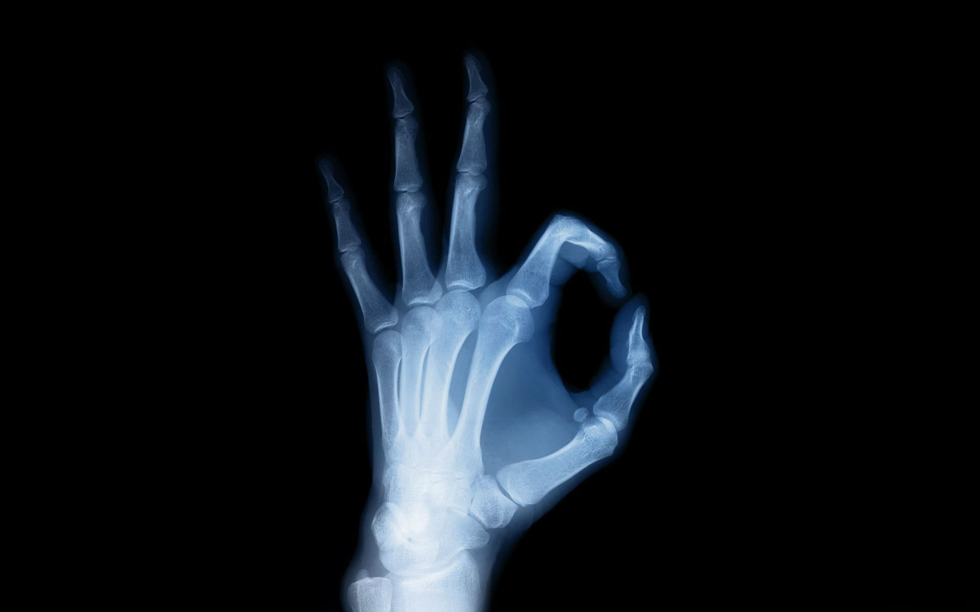 217991 Hintergrundbild herunterladen röntgen, fotografie, anatomie, hand, röntgenblick - Bildschirmschoner und Bilder kostenlos