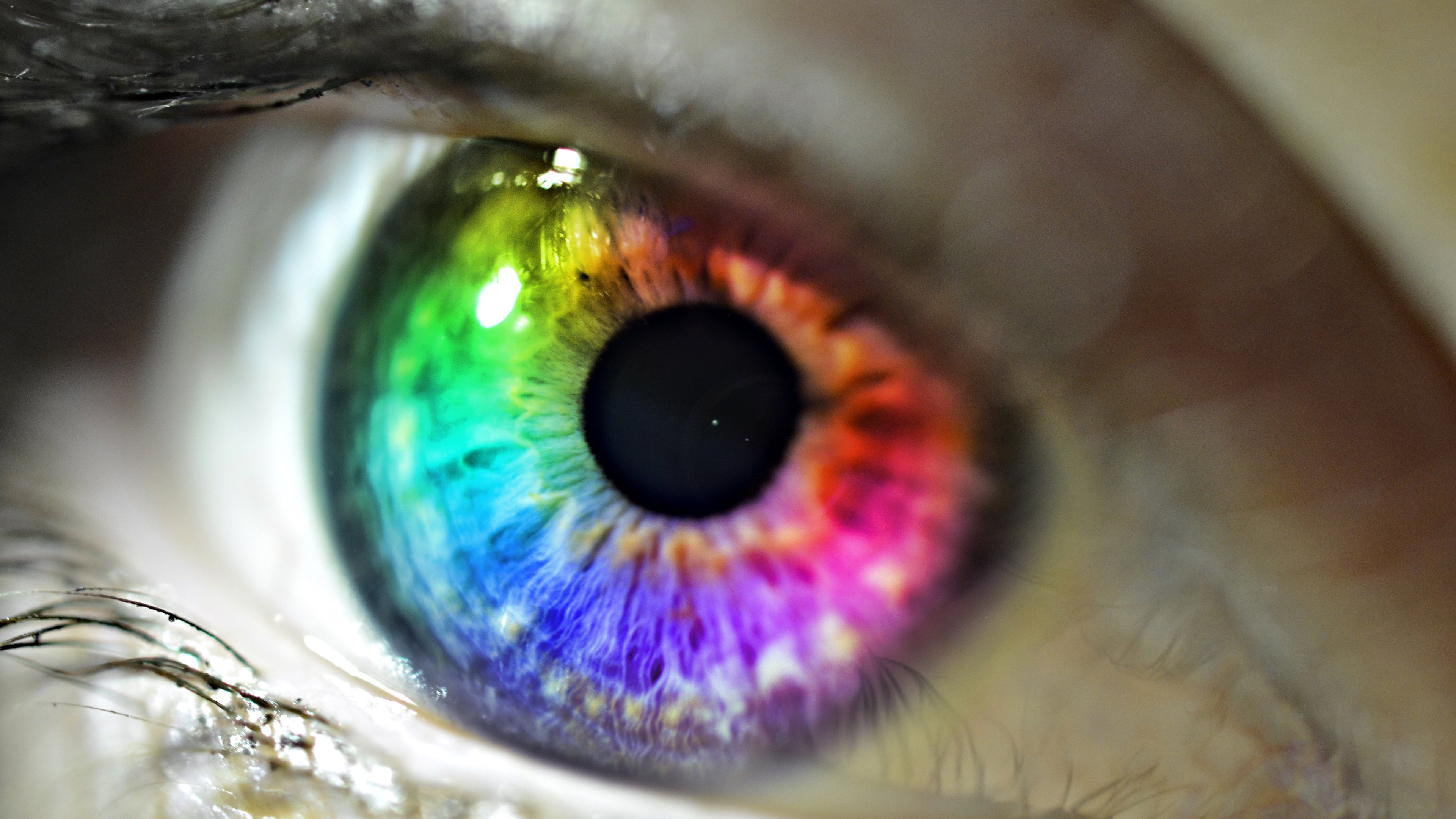 Разноцветная радужка глаза